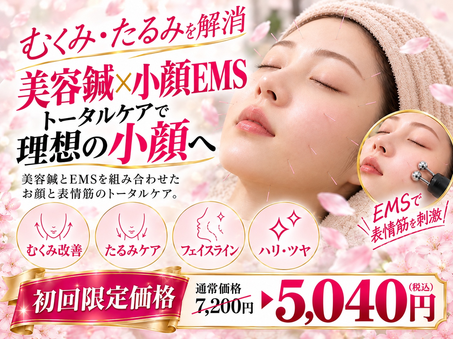 美容鍼×小顔EMS。通常7,200円から初回限定5,040円（税込）のクーポン画像。